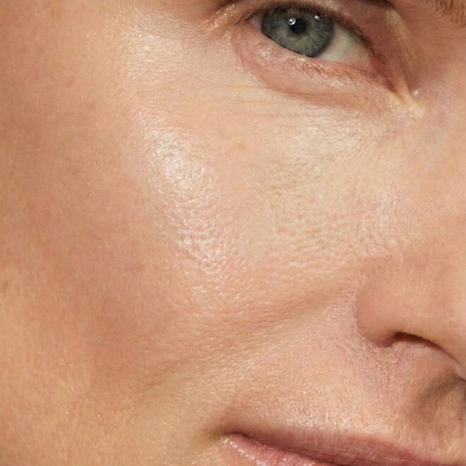 LoweSkin image